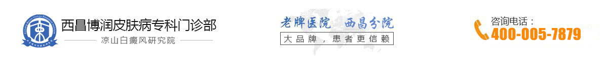 凉山西昌白癜风医院哪家好